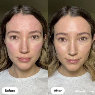 Calmea Farbkorrektur-Balm